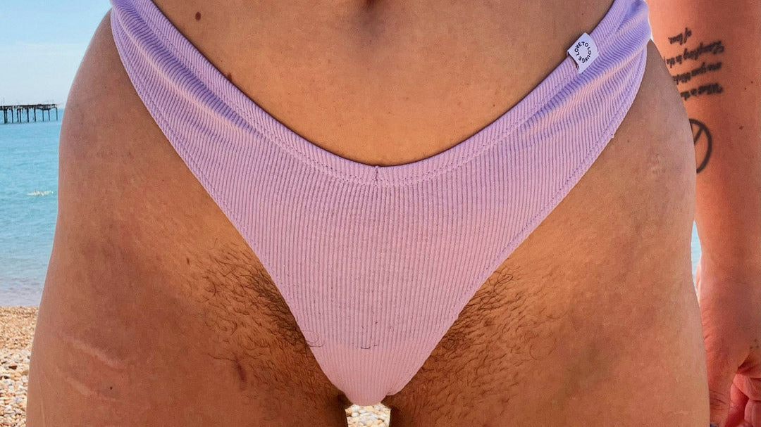 Woman in bikini bottoms with pubic hair.