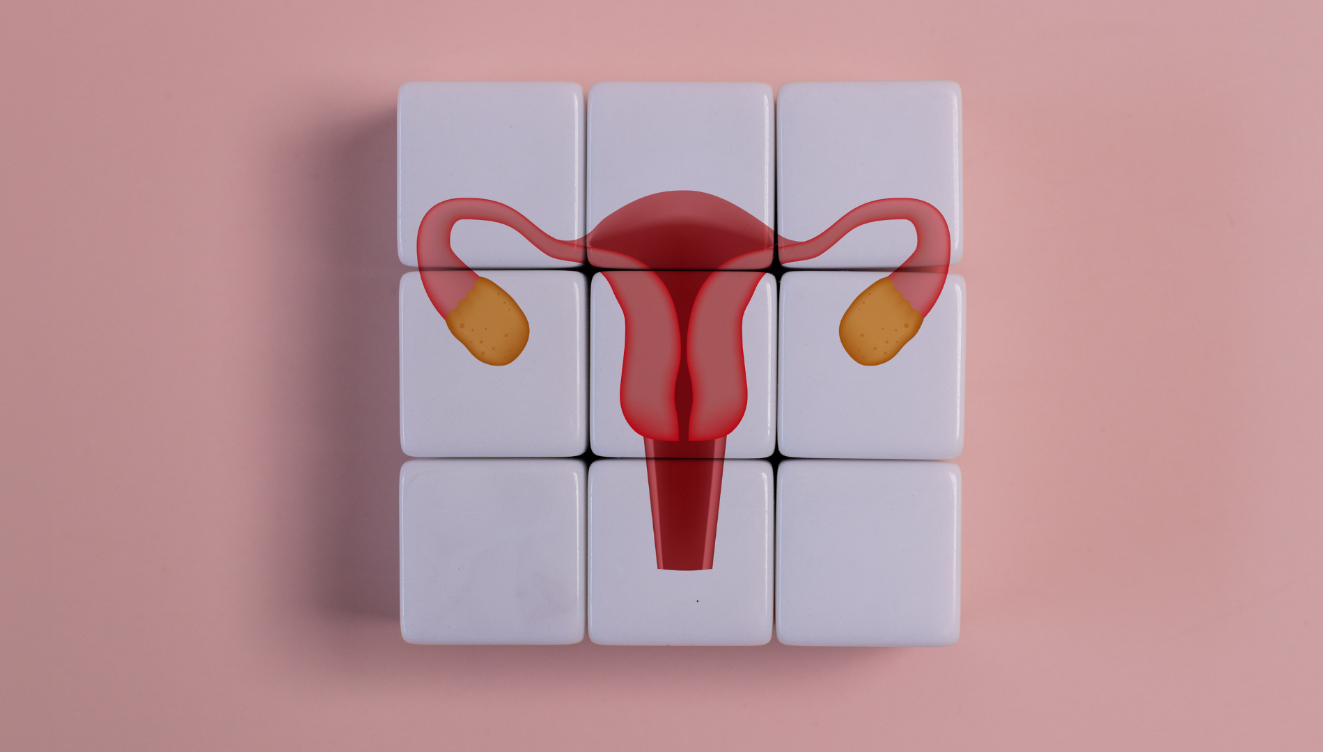 Illustration of human ovaries and uterus, highlighting the reproductive system affected by Polycystic Ovary Syndrome (PCOS)