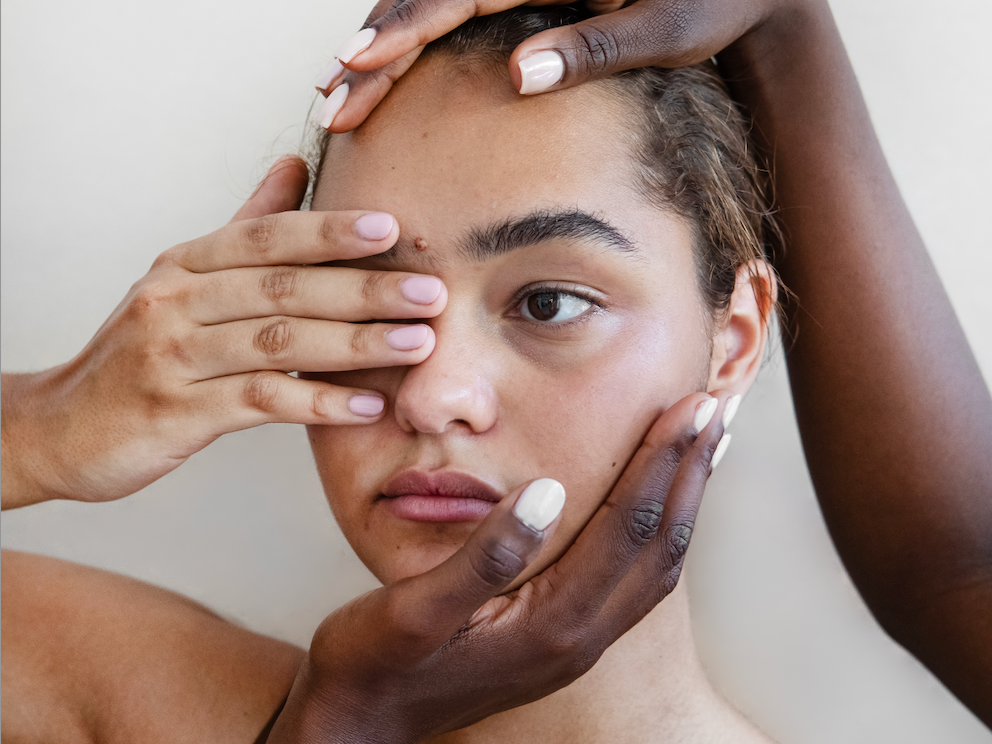 Woman's head and shoulers, she is covering her eye with her hand and someone else's hands are on the top of her head and around her cheek. 