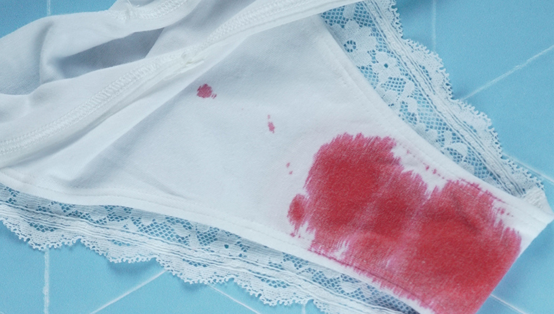 Underwear with visible blood stain, representing unexpected vaginal bleeding that may occur alongside urinary tract infection symptoms
